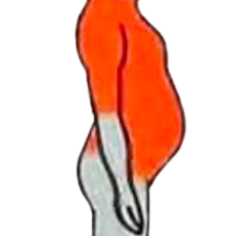 Eliminar 1kg a 5kg
